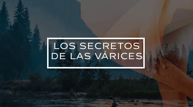 LOS SECRETOS DE LAS VARICES